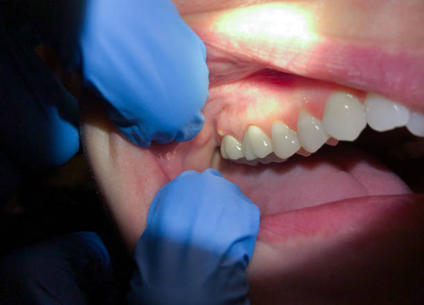 Best Urgent Tooth Repair  in Brinkley, AR